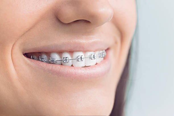 Best Tooth Extraction  in Kendallville, IN